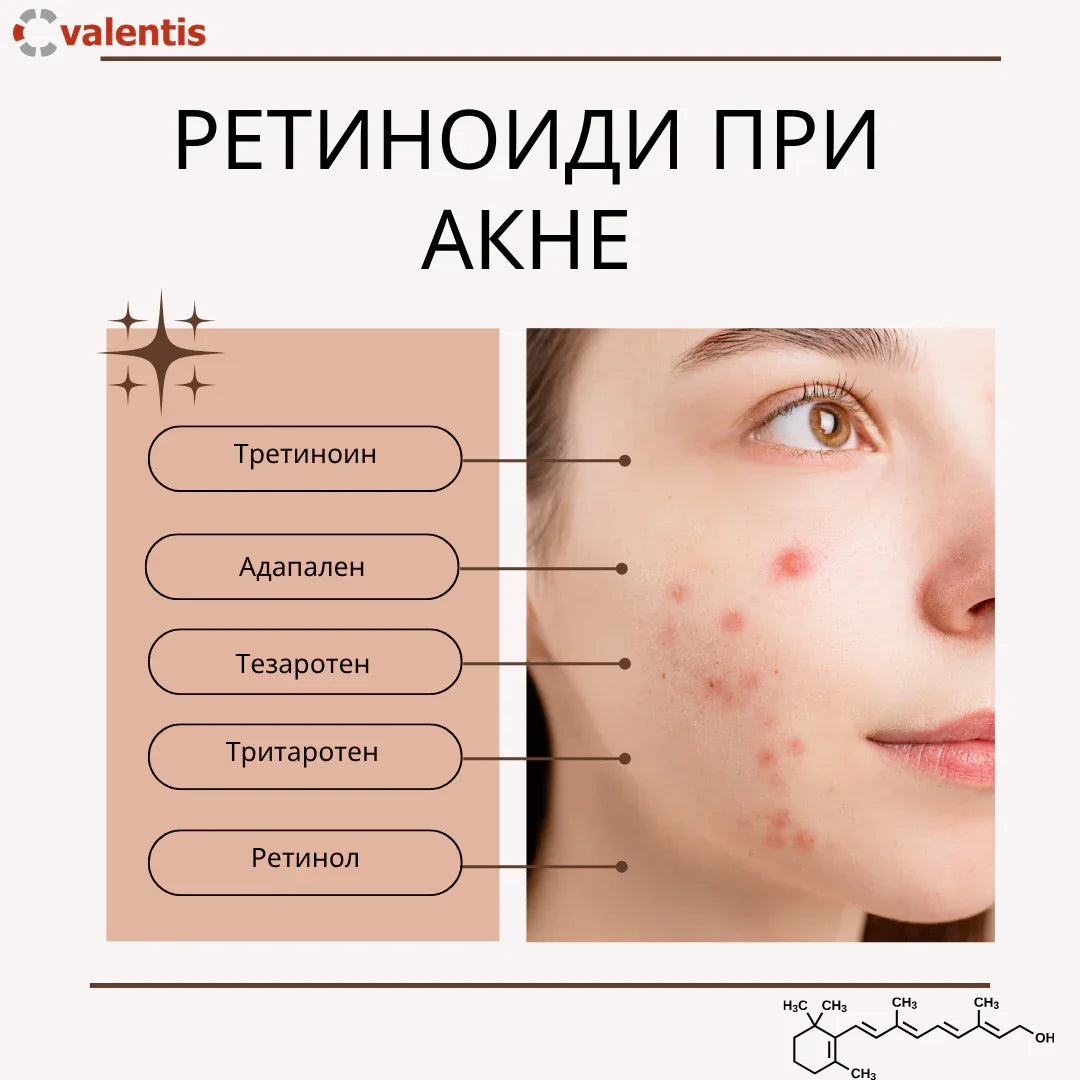 Ретиноидите – златният стандарт в грижата за кожа с акне