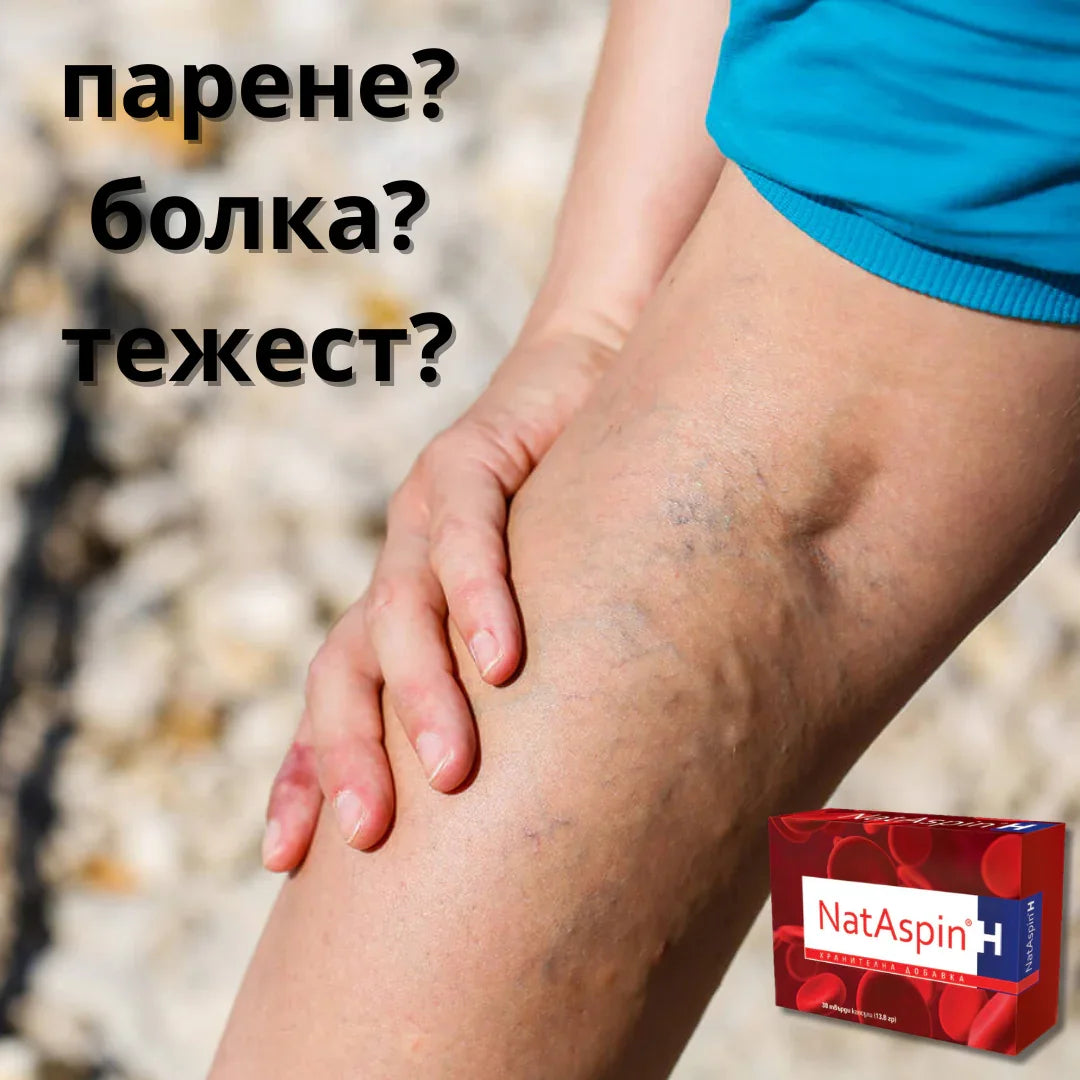 Разширени вени – какво трябва да знаем